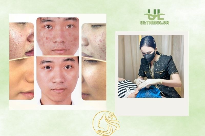 Thẩm Mỹ Queen Spa - Long An
